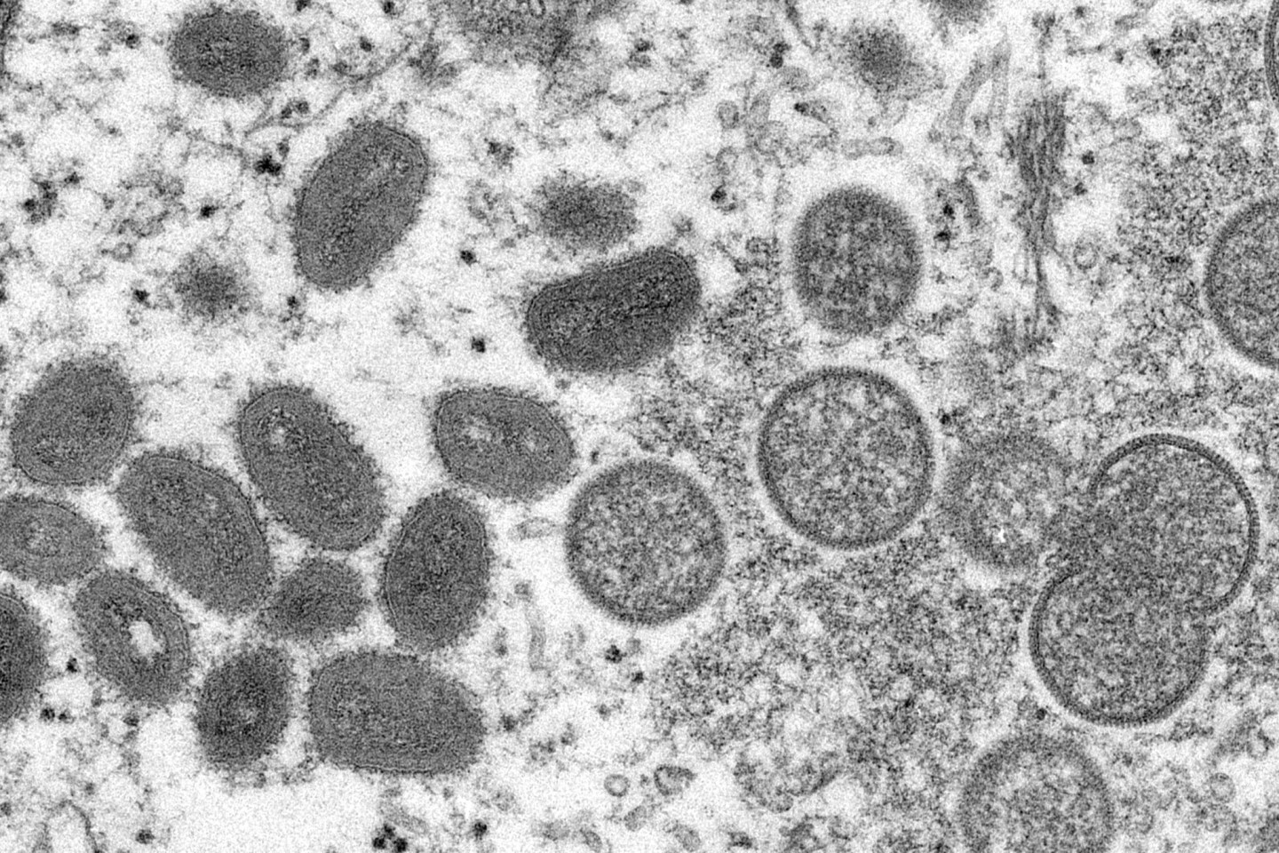 Diese elektronenmikroskopische Aufnahme zeigt reife, ovale Affenpockenviren (l) und kugelförmige unreife Virionen (r), die aus einer menschlichen Hautprobe stammen.