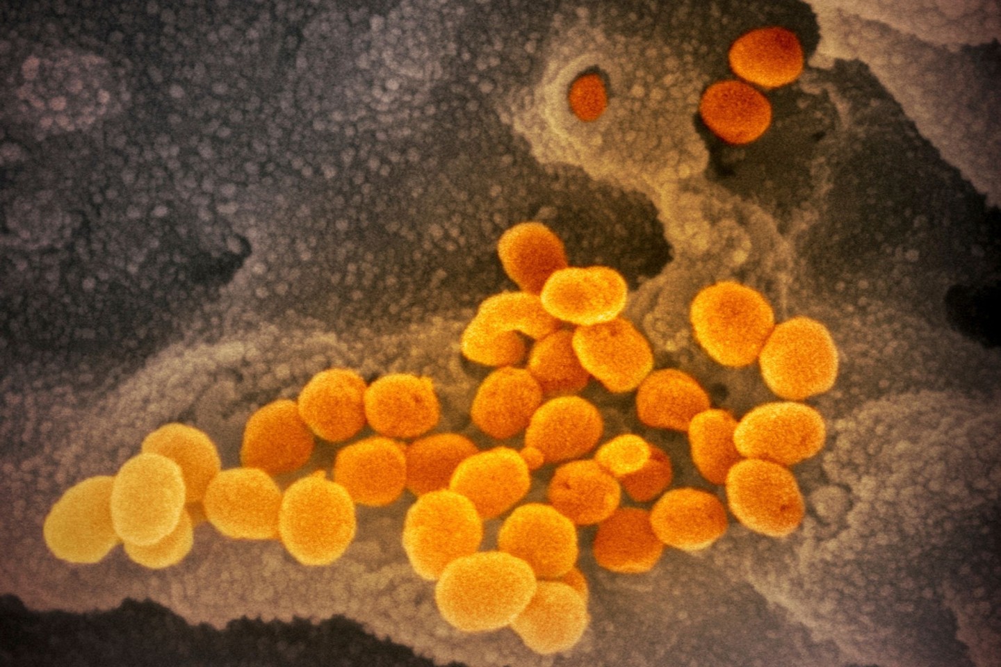 Eine elektronenmikroskopische Aufnahme zeigt das neuartige Coronavirus, das aus der Oberfläche von im Labor kultivierten Zellen austritt.