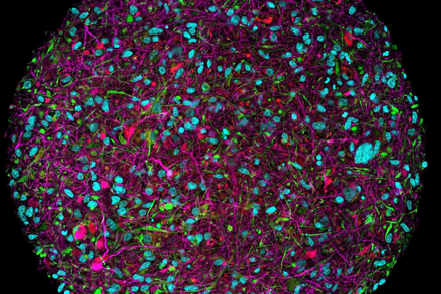 Vergrößertes Bild eines im Labor gezüchteten Hirnorganoids mit Fluoreszenzmarkierung für verschiedene Zelltypen.