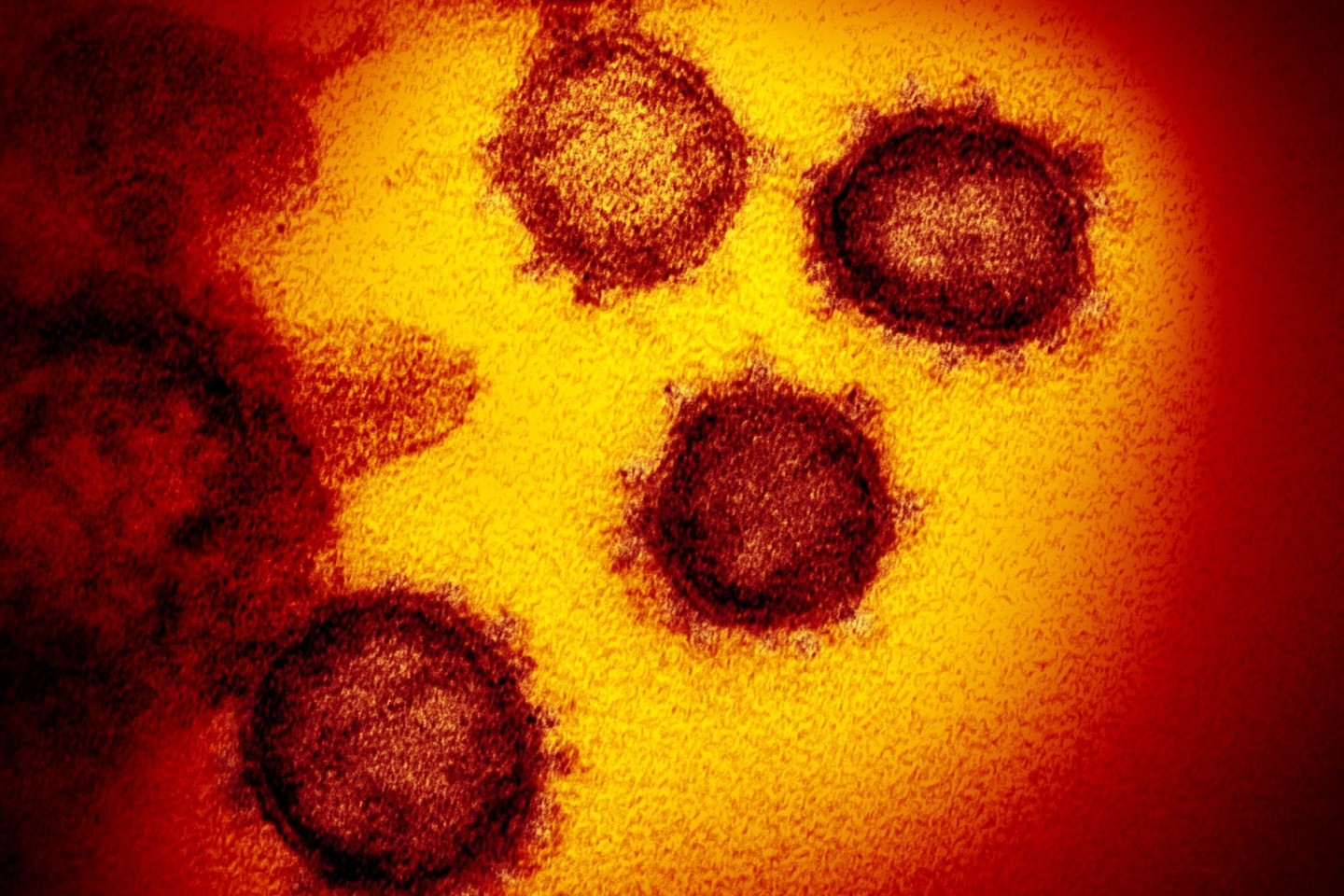 Die vom National Institute of Allergy and Infectious Diseases zur Verfügung gestellte Elektronenmikroskopaufnahme zeigt das Coronavirus SARS-CoV-2, das von einem Patienten in den USA isolie...