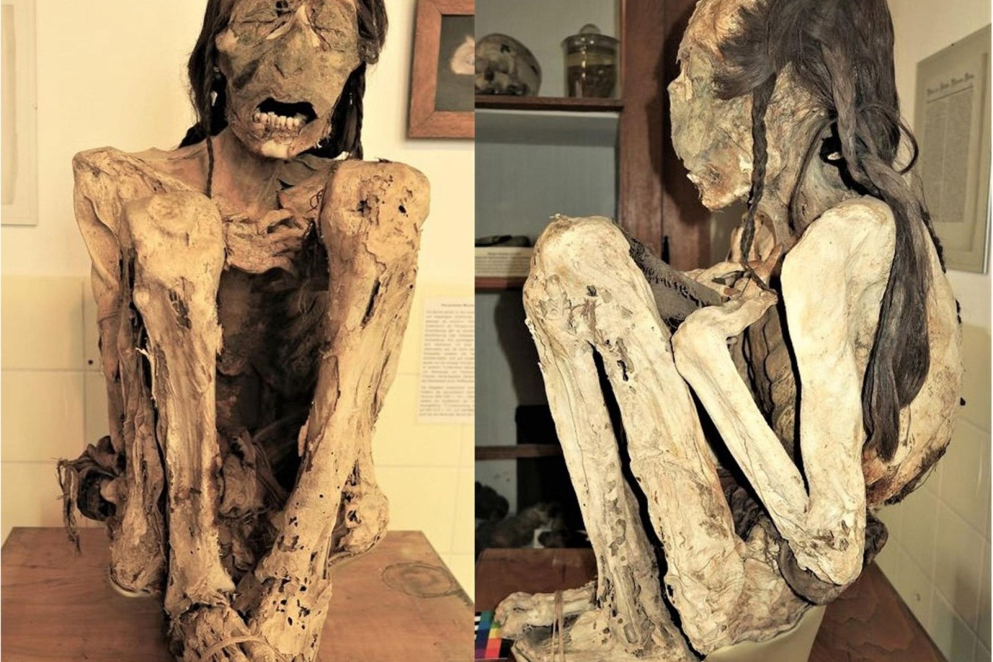 Forscher untersuchten südamerikanische Mumien.