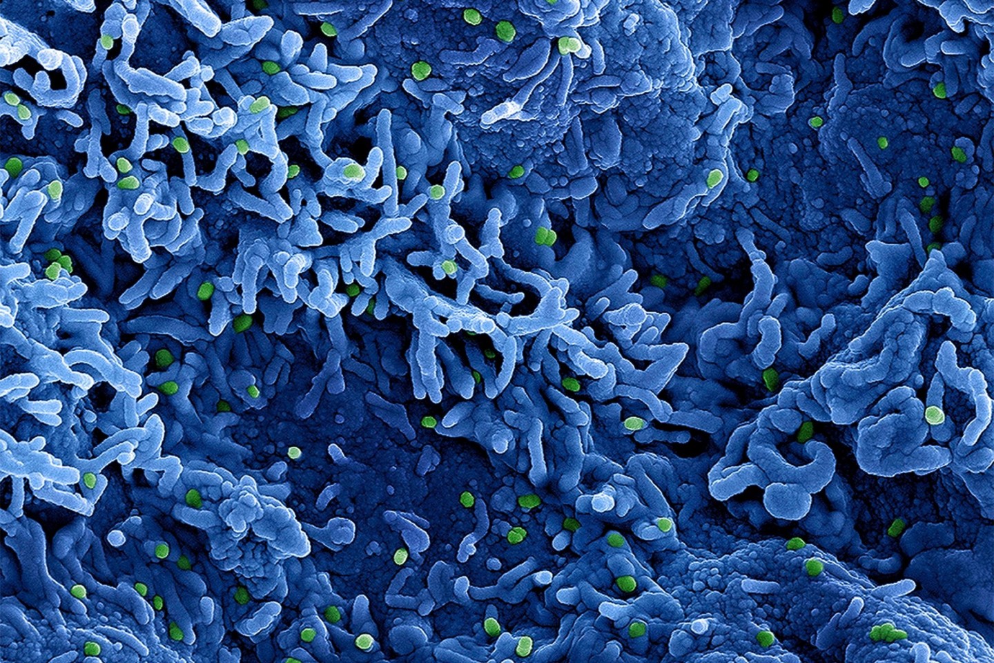 Eine kolorierte rasterelektronenmikroskopische Aufnahme des Affenpockenvirus (grün) auf der Oberfläche von infizierten VERO E6-Zellen (blau).