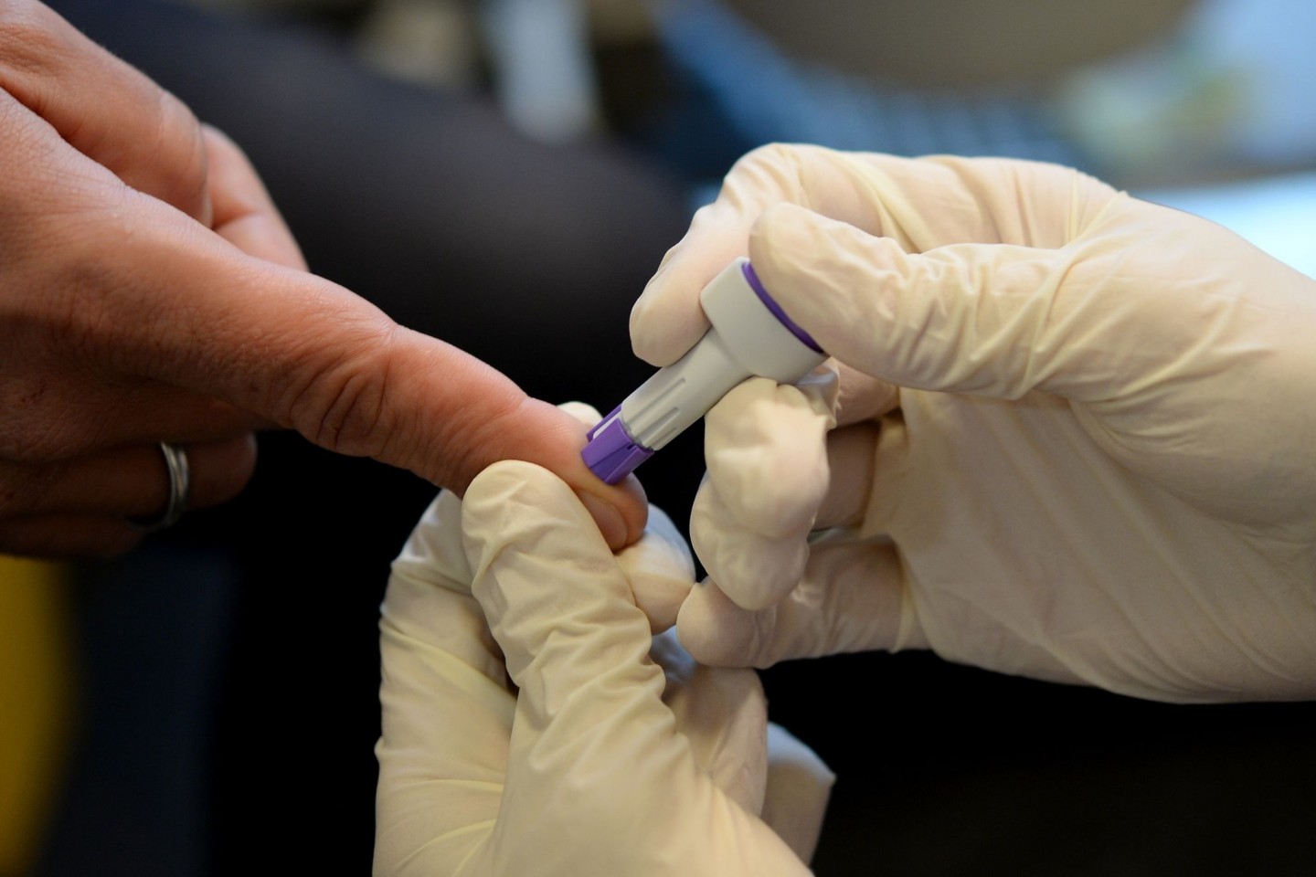 Ein Arzt nimmt an dem Finger eines jungen Mannes Blut ab. In vielen Ländern ist die Zahl der HIV-Tests in der Pandemie zurückgegangen.