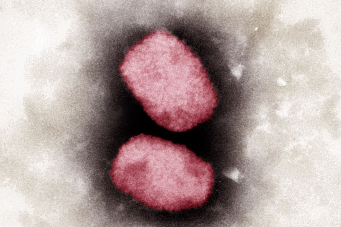 Elektronenmikroskopische Aufnahme von Affenpocken-Viren, koloriert.