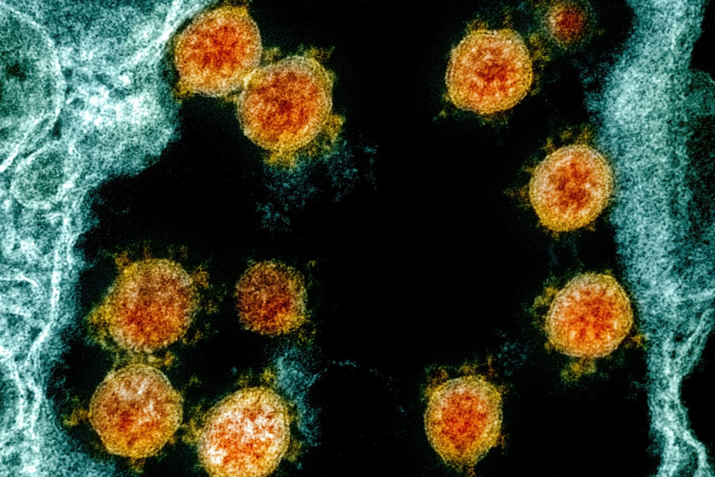 Partikel des Coronavirus SARS-CoV-2 wurden für eine elektronenmikroskopische Aufnahme am «National Institute of Allergy and Infectious Diseases Integrated Research Facility» farblich bear...